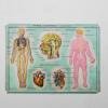 Medical tables
