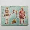 Medical tables