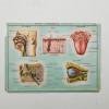 Medical tables